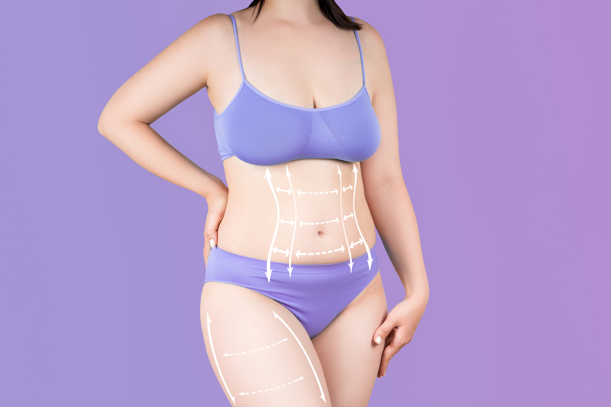 Featured image for 6 Myths About Liposuction