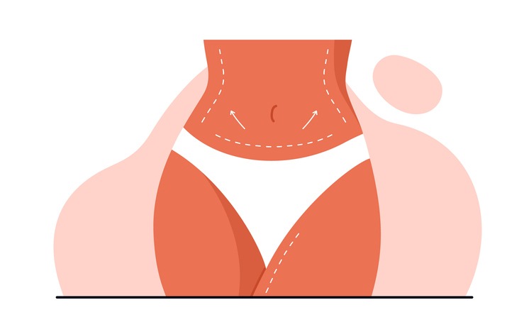 Featured image for Guide to Tummy Tuck Recovery