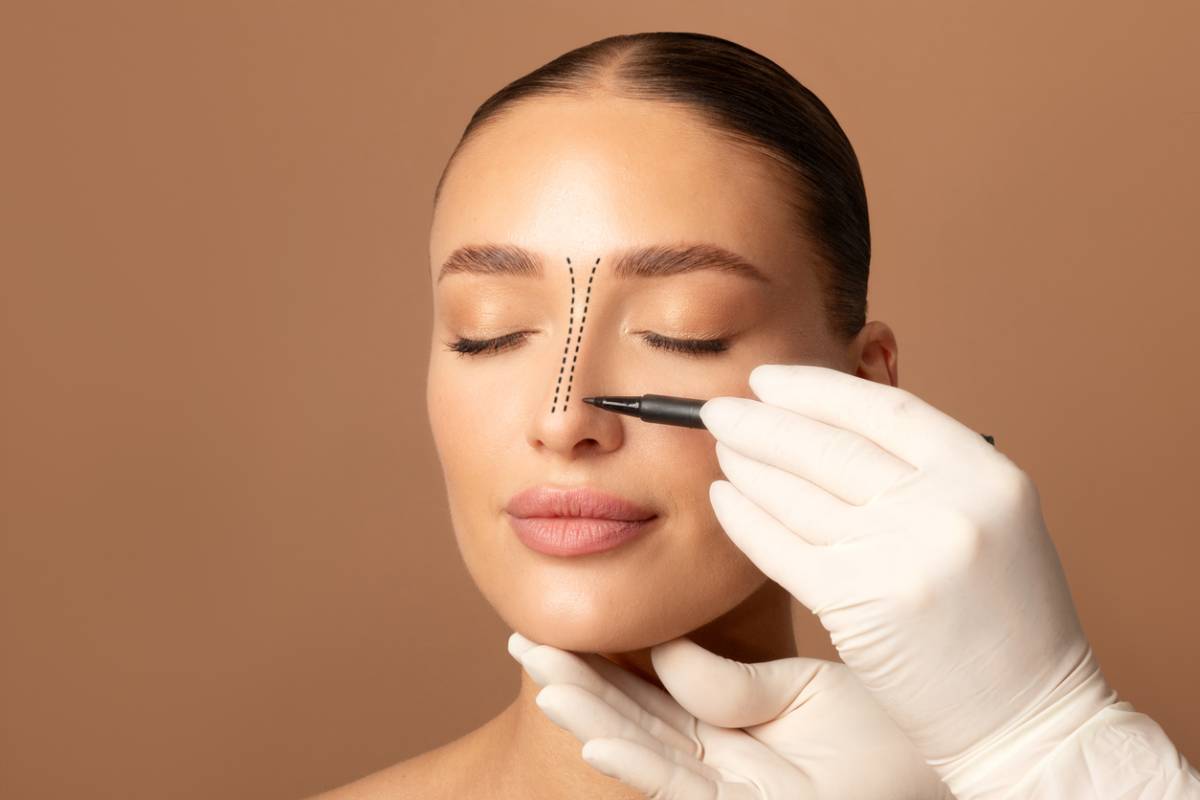 Featured image for How Long Does It Take a Nose Job to Heal